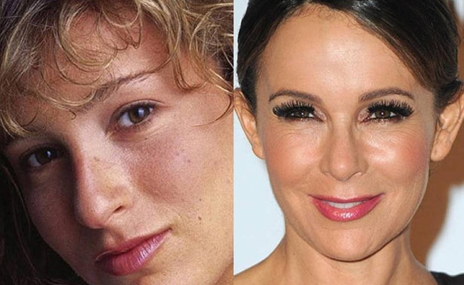 Jennifer Grey Before and After