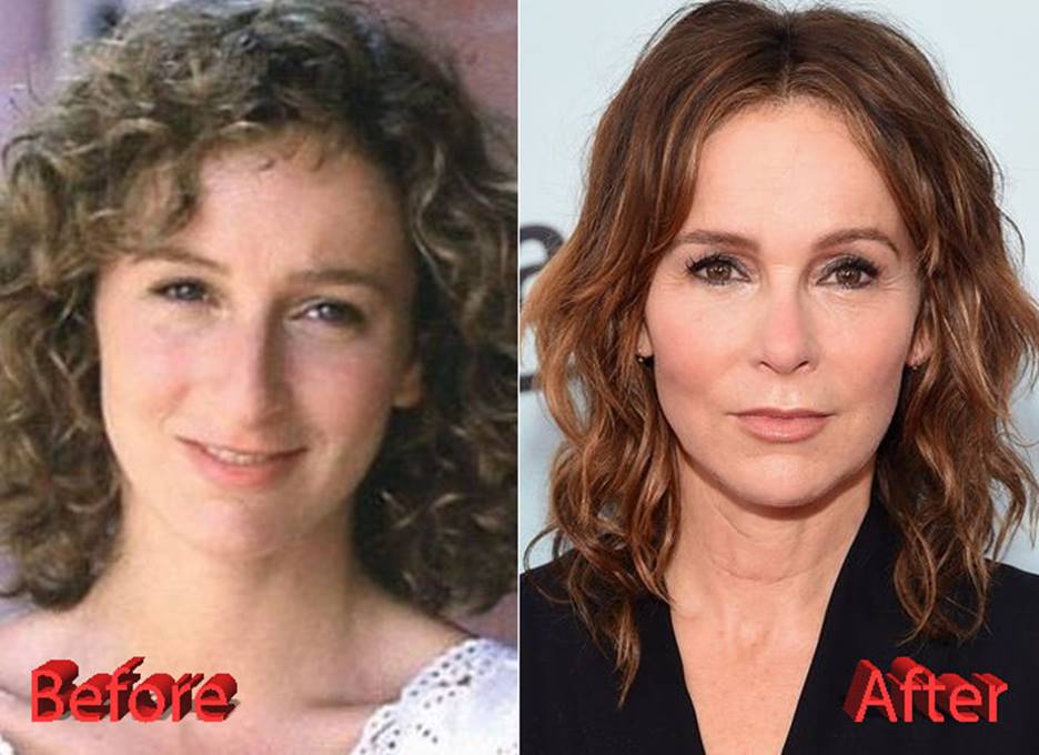 Jennifer Grey’s Before and After Plastic Surgery Effect on Her Stardom